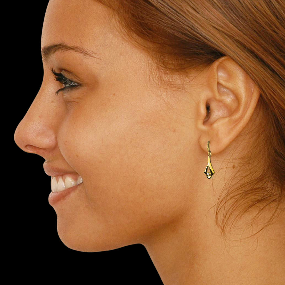 https://www.goldiam.co.il/sites/default/files/3777_ear.jpg